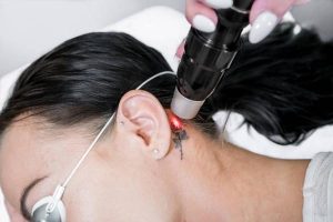 Say Goodbye to Unwanted Tattoos with Professional Removal